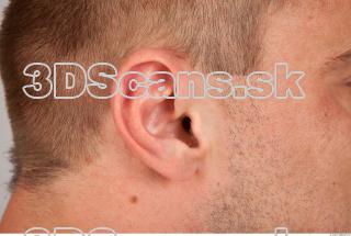 Ear texture of Gene 0001